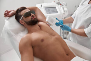 laser hair removal