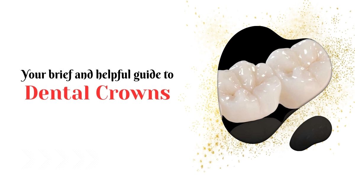 Your-brief-and-helpful-guide-to-dental-crowns
