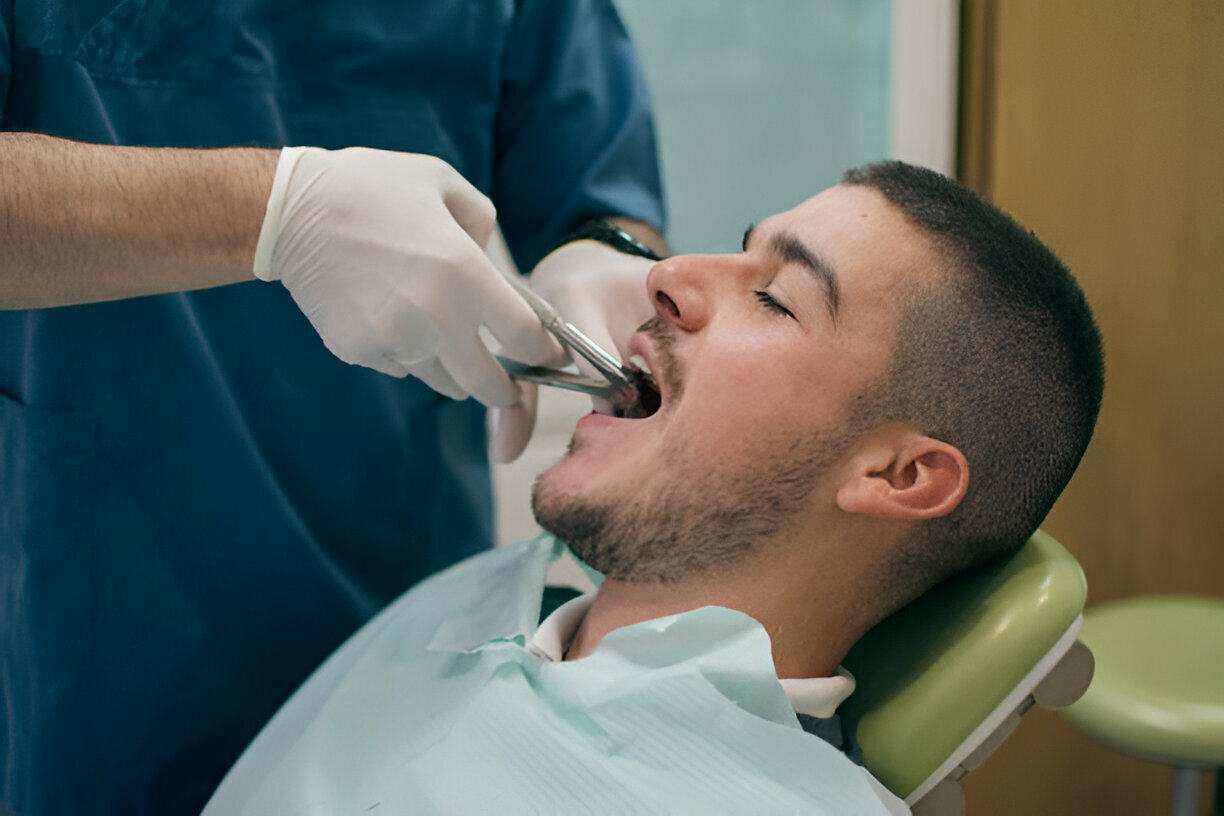 A Step-by-Step Guide to the Tooth Extraction Process