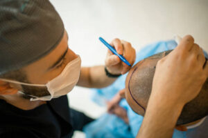 hair transplants in Abu Dhabi