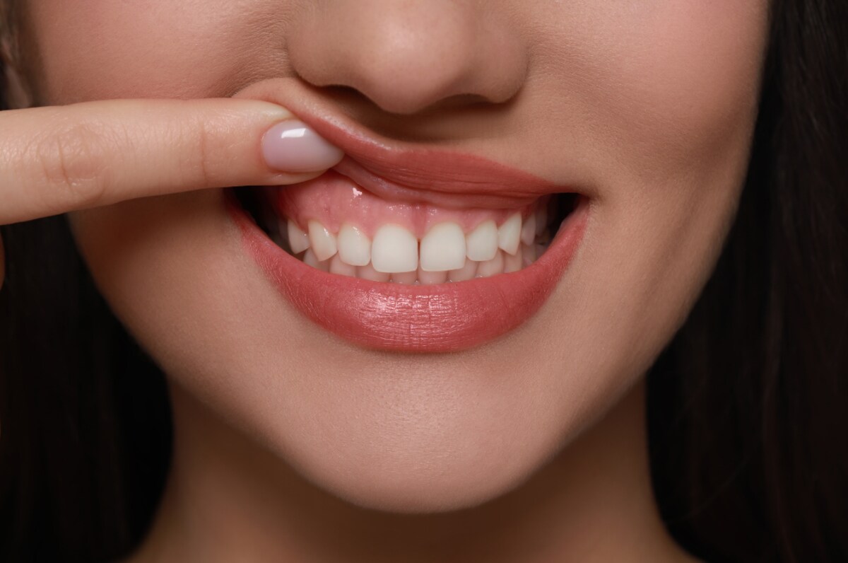 crown lengthening enhancing your smile and oral health