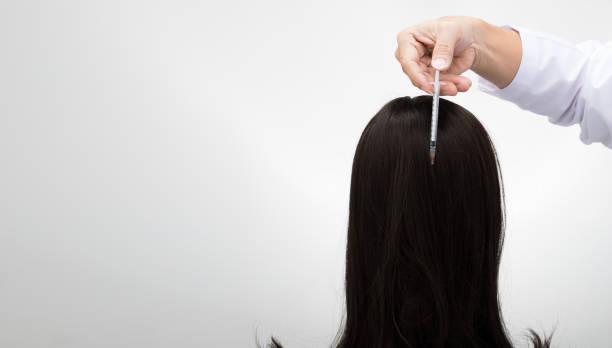 PRP hair treatment in Abu Dhabi