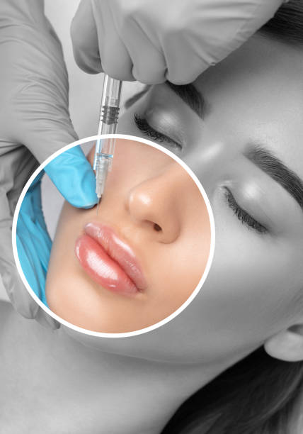 rhinoplasty in Al Ain