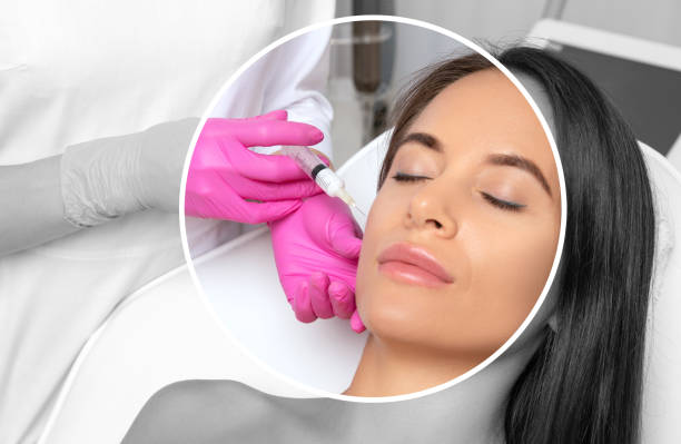 dermal fillers in Abu Dhabi