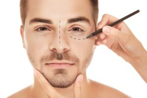 Cosmetic and Plastic Surgery : Scar Removal, Eyelid Surgery, Liposuction & More