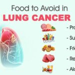 Foods to Avoid for Lung Cancer Patients