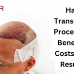 hair transplant cost