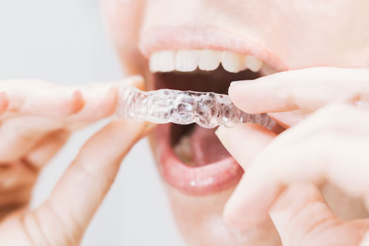 How Invisalign in Valencia Can Transform Your Smile