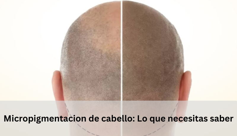 micropigmentacion de cabello