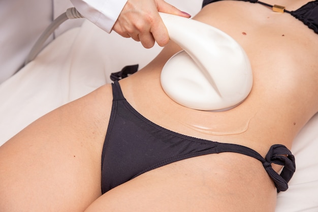 Laser liposuction in Dubai