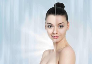 Lighten Your Skin Tone with Effective Skin Whitening Treatment in Abu Dhabi