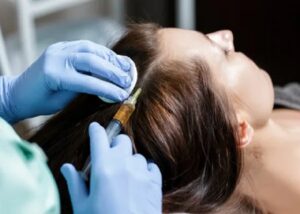 PRP hair treatment in Riyadh