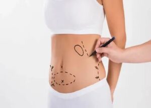 liposuction in Jeddah