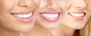 teeth whitening Corio